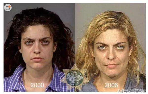 触目惊心吸毒前后真实的变化,吸毒的危害到底有多严重图片