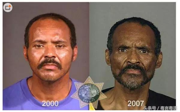 触目惊心吸毒前后真实的变化,吸毒的危害到底有多严重图片