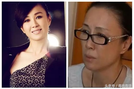 10个吸毒前后的惊人变化,吸毒的人吸毒前后对比图片