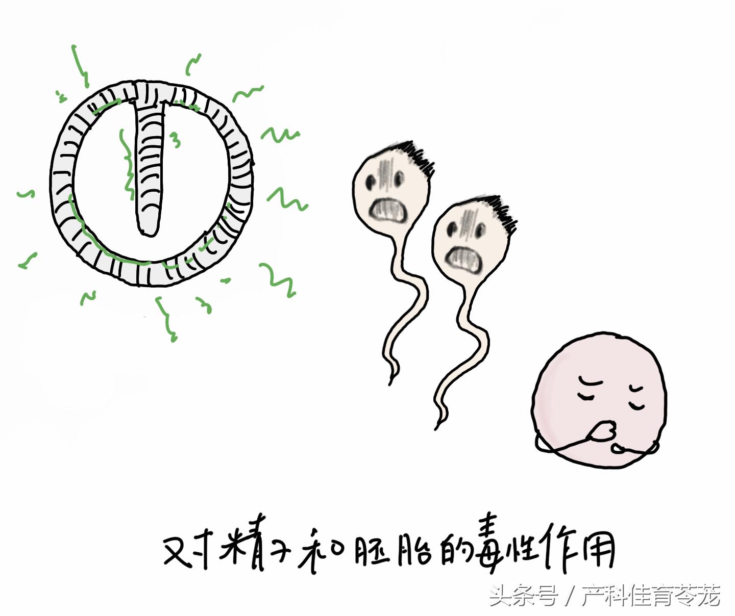 图解宫内节育器放置流程