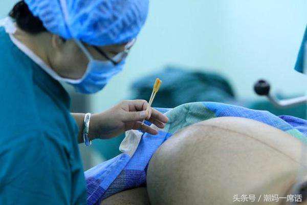 可怕的剖腹产疤痕,真正剖腹产疤痕