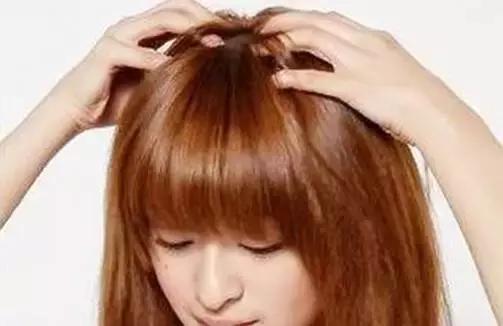 教你一招告别脱发掉发,90后脱发自救的秘方