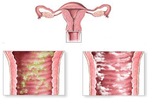 春玲治什么病,春玲医生上皮细胞肿瘤严重吗