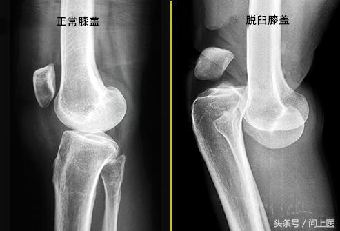 老年人膝盖疼痛的原因和治疗方法,膝盖疼痛的原因和解决方法