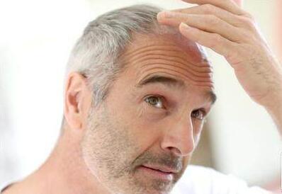 睡眠不足会掉头发吗,睡眠不足会掉头皮吗