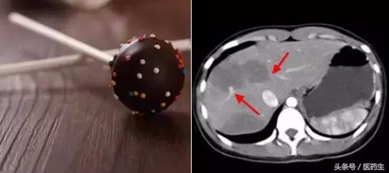 舌尖上的医疗,舌尖上的医疗篇