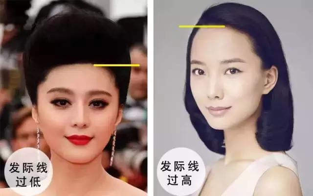 90后脱发的原因和治疗方法,中年脱发真的是一大考验