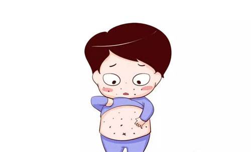 荨麻疹皮肤痒偏方,荨麻疹最简单自愈方法婴儿
