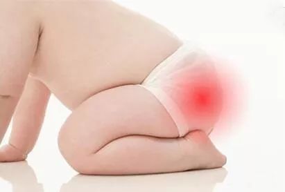 大白罐可以预防孩子红屁屁吗,预防红屁屁是擦油好还是擦粉好