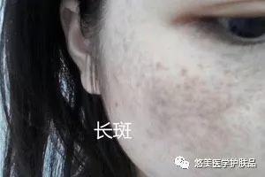 鑸掑┓鎶よ偆,鑸掑┓绁涚棙