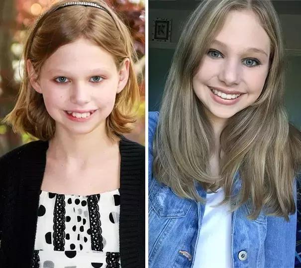 后悔整牙和不后悔整牙,整牙一般整到什么样就可以了