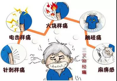 手术天下第一疼是什么手术,天下第一痛三叉神经痛到底有多痛