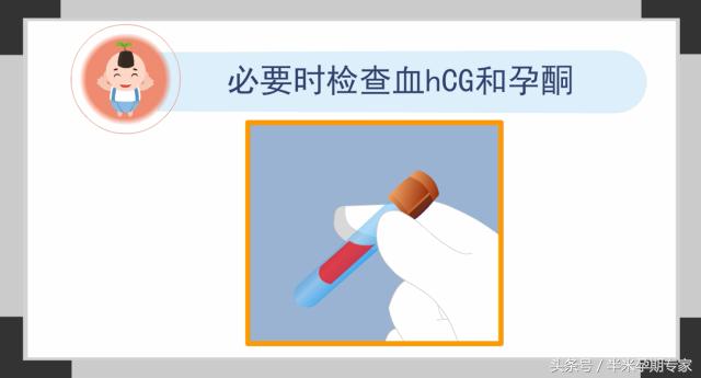 人工流产胚胎,胚胎停育人工流产后多久可以怀孕