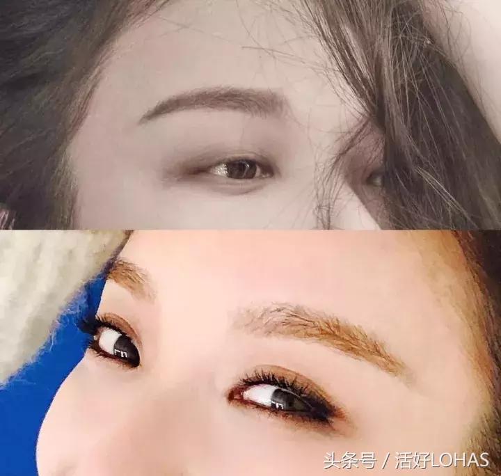 拯救发际线的生发神器,拯救发际线神器