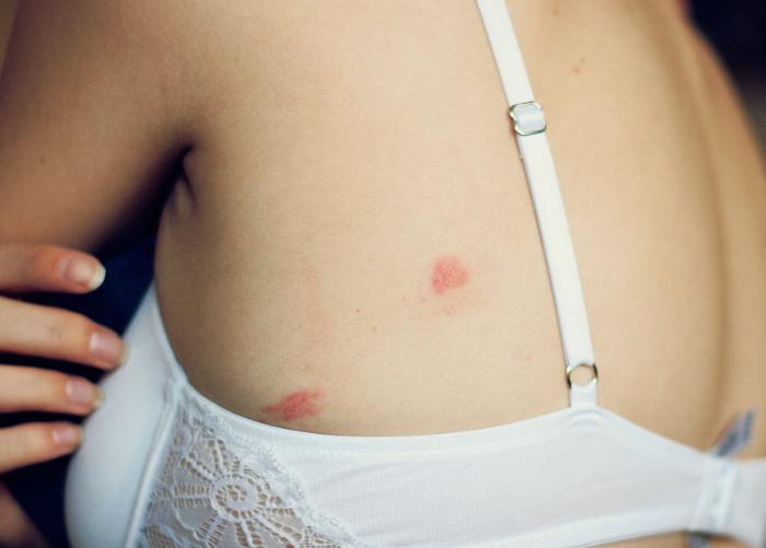 养一盆好养活又好看的花,牙疼养什么花最好