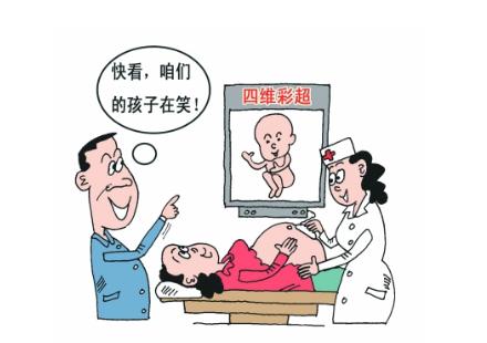 做四维的时候宝宝居然笑了,四维一遍过宝宝是聪明还是不聪明