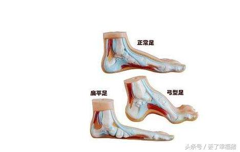 脚部出现这些问题可能是疾病先兆,脚不容忽视的健康信号