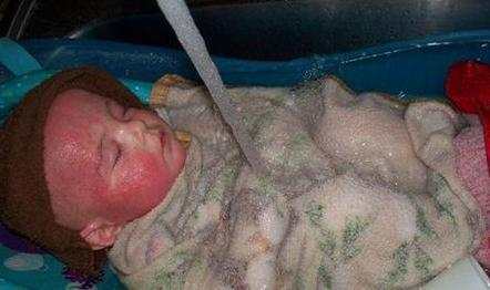 宝宝肤专家可以治疗湿疹吗,一岁半宝宝湿疹怎么治疗