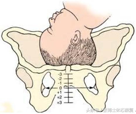 孕妇耻骨痛怎么锻炼,孕期耻骨疼多锻炼可以缓解吗
