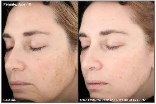 雅诗兰黛小棕瓶配白泥,雅诗兰黛小棕瓶精华搭配原生液