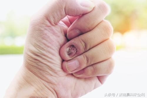 三甲医院通用的《疾病先兆自查表》,我用了几十年,现在还在用!