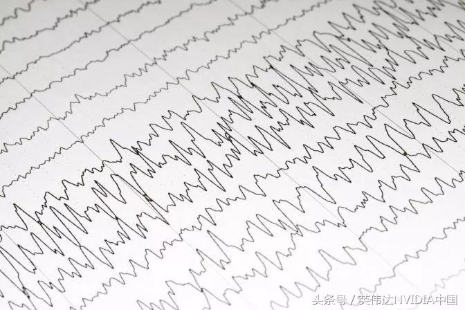 ai可提前一小时预测癫痫发作,ai预测癫痫成功案例