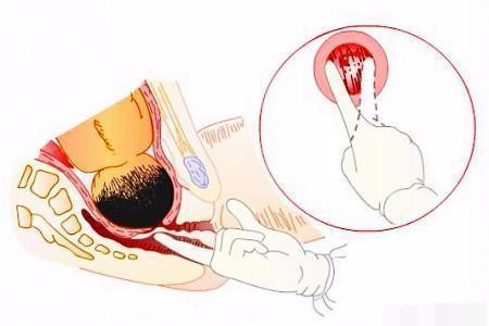 分娩最痛苦的时间多久,第一次分娩宫口开十指需要多久