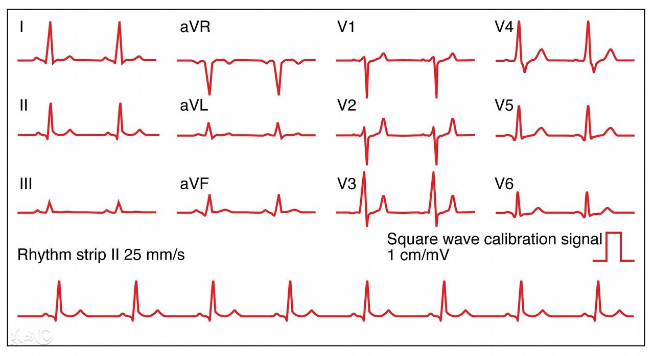 看胎心率辨别胎儿有科学依据吗,胎心率看胎儿识别方法真的很准吗