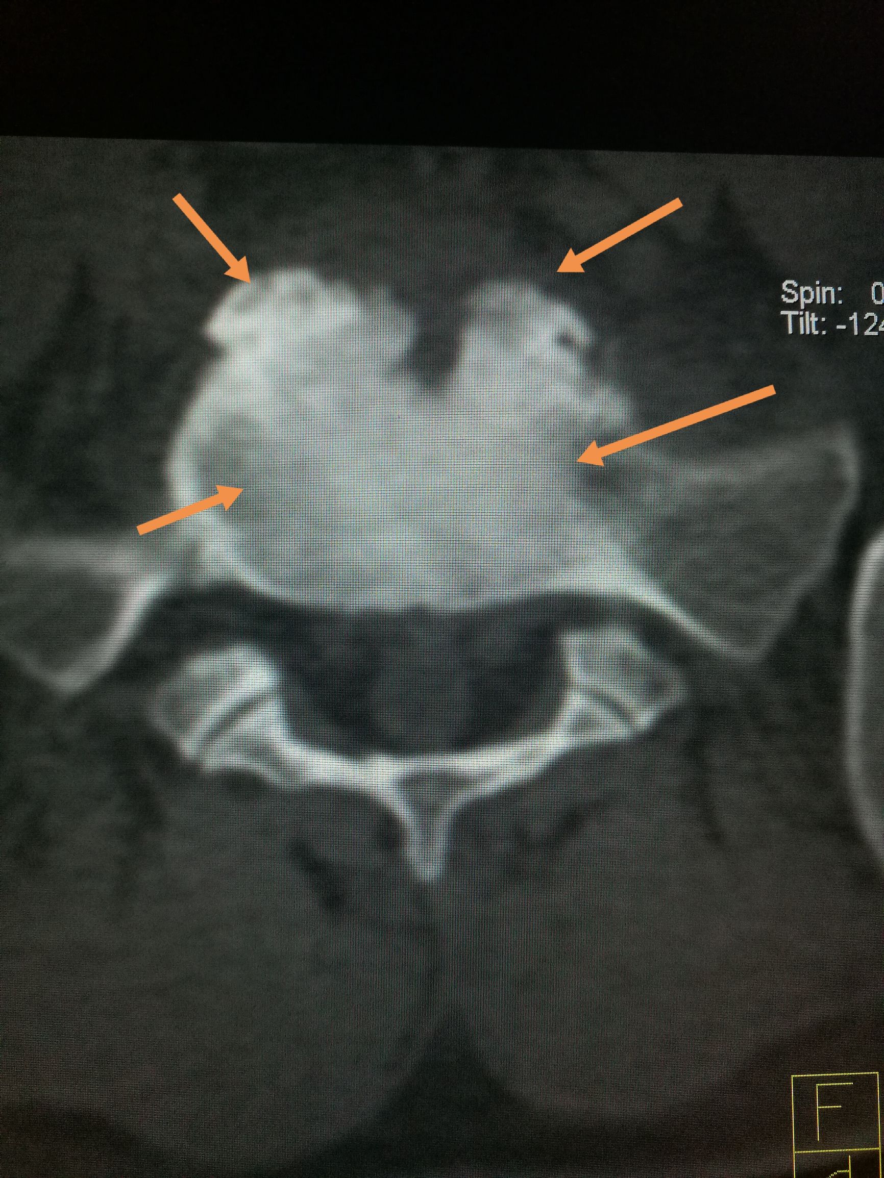 吃羊肉腰胀疼是怎么了,经常吃牛羊肉身体有啥变化