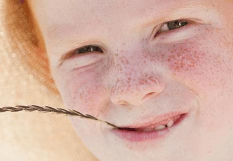 你脸上的斑代表什么含义,脸上开始长斑的原因是什么