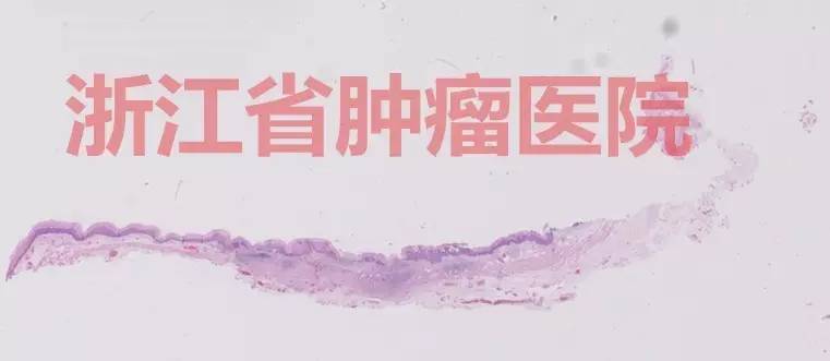 食管黏膜病变越大就一定是恶性吗,食管病变严重需要怎么治疗