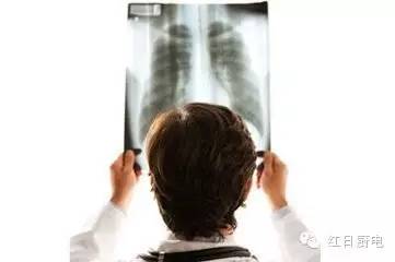 红日油烟机好还是美的烟机好,奥铂特烟机跟红日烟机哪个好