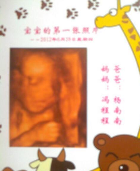 超快顺产7斤的宝贝,超快顺产6斤4两宝宝