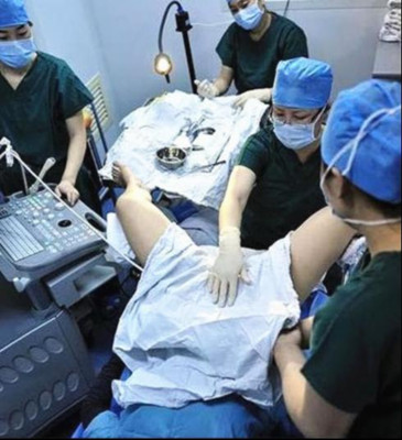 做试管婴儿是不是特别痛苦 (做试管婴儿多长时间就知道成功了)