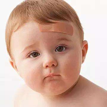 宝宝脑袋摔了包用什么药,宝宝脑袋摔了个大包