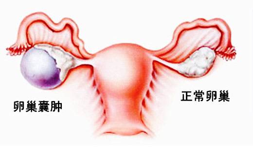 女人没有卵巢会有月经吗,没有卵巢的女人
