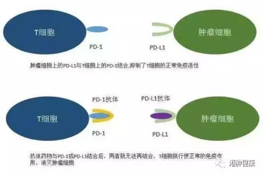 女性常见肿瘤之卵巢癌的免疫治疗