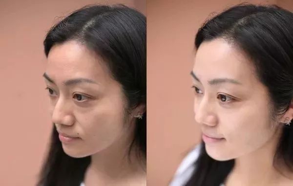 清晨喝水清理肠道垃圾最好的方法,清理肠道垃圾最快的办法是什么