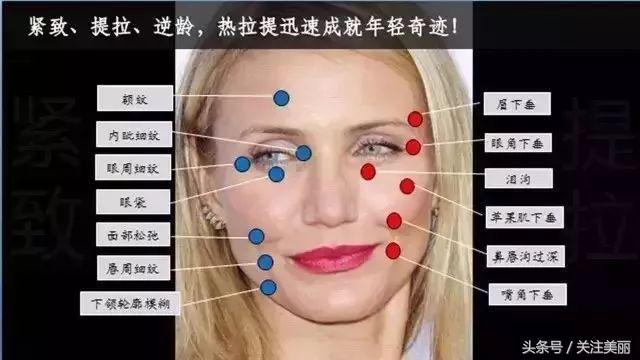 为什么热拉提这么便宜,热拉提多久做一次效果好