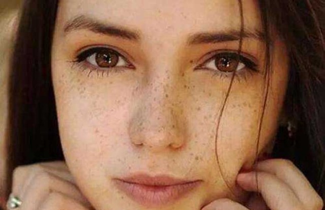 果酸换肤美白效果,果酸换肤和m22光子嫩肤哪个先做