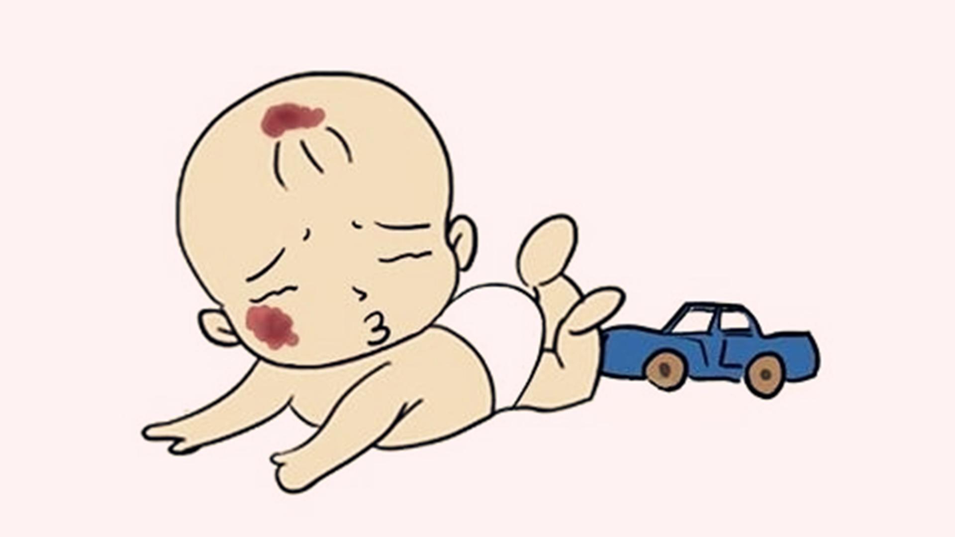 小孩子得血管瘤好医吗,大腿肌肉血管瘤不治一般能活多久