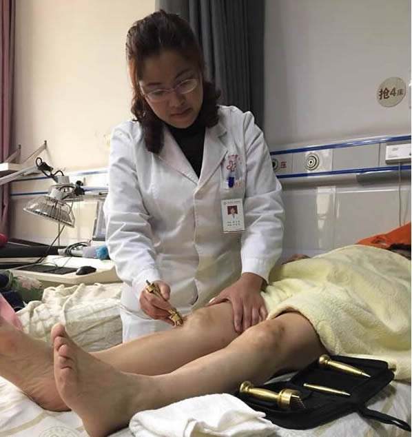 中医扎针治痛经,杵针疗法视频