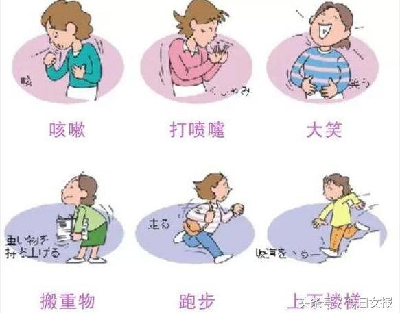 产妇42天盆底肌筛查,生完孩子去医院做盆底肌筛查