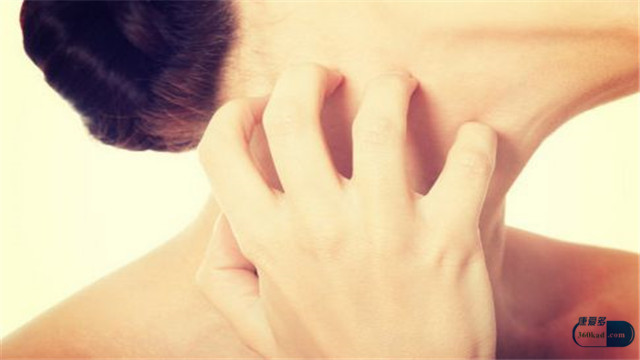 小康说药,皮肤病血毒丸治皮肤瘙痒吗