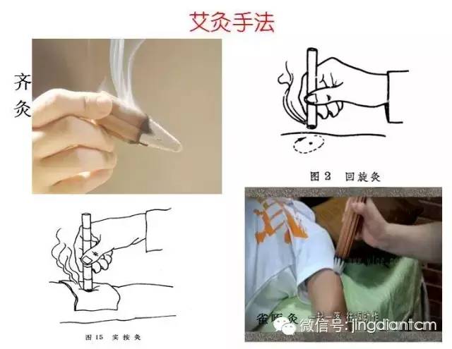 中医名家艾灸视频全集,中医艾灸知识100例
