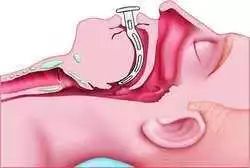 足球比赛队医药品清单,足球比赛需要准备哪些药品