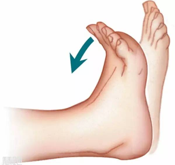 全球治好足跟痛,足底疗法治百病