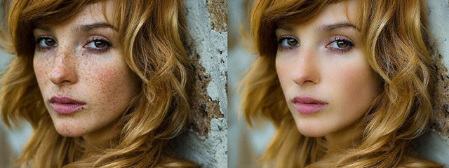 去看皮肤科治疗雀斑问什么问题,去医院什么科治疗雀斑