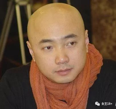 怎么防治中年男士发际线后移,18岁男发际线后移怎么补救