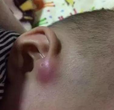 仓眼为什么是黑色,为什么会有仓眼